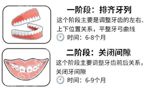 深圳北大医院牙齿矫正价格表公布!价格表、医院医生信息速码!