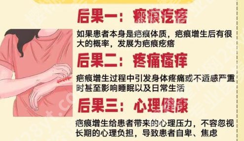 浙大二院疤痕好吗？附挂号指南与真实案例