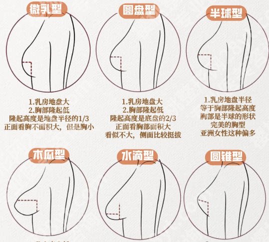上海东方医院整形外科是外包的吗？隆胸真实案例展示！
