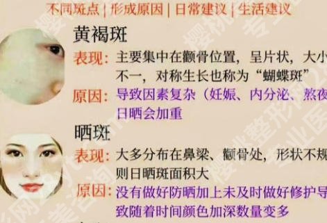 深圳北大医院激光祛斑效果怎么样？真人案例和术后注意事项盘点