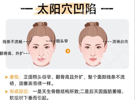 上海六院磨骨手术费用揭晓！收费明细及术后真实反馈一篇看懂