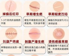 上海仁济医院去疤痕多少钱？效果、价格全透明