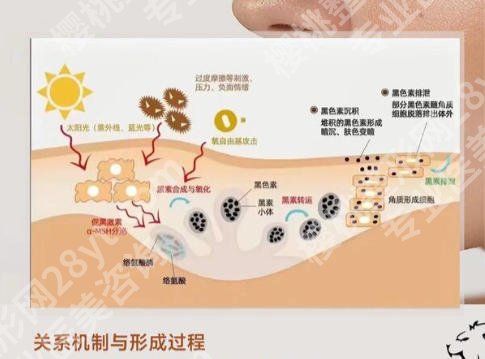 宜兴人民医院激光祛斑怎么样?看看医院技术能力怎么样?
