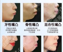 深圳市第二人民医院牙齿矫正费用公布！医师技术实力盘点