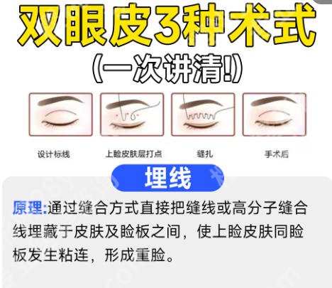 南方医科大学南方医院美容外科怎么样？附医院详细介绍与客户点评