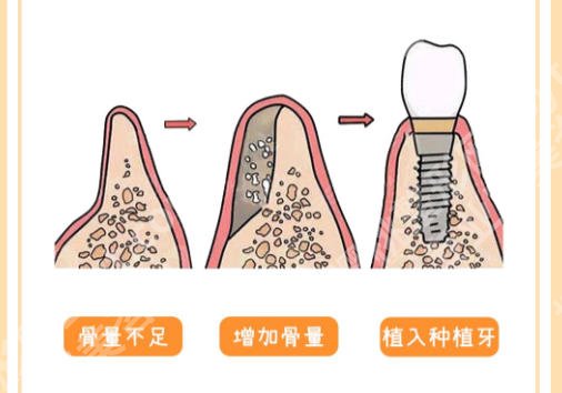 广医一院口腔科易晓辉怎么样？附医生详细介绍与案例分享