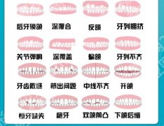 上海华山医院正颌手术价格表公布！颏成形术1万5左右起！含医院简介