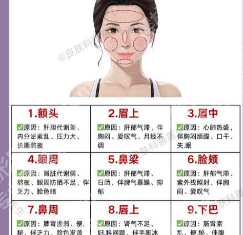 中山大学附属第三医院激光祛斑贵吗?价格细节、真实体验全分享了