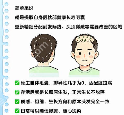 重庆哪家医院植发效果好？这5家闭眼冲不踩坑、公立私立全拿捏