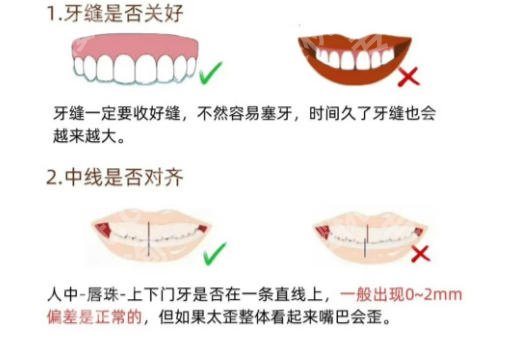 滁州第一人民医院口腔科价格公示！收费标准靠谱大全一览