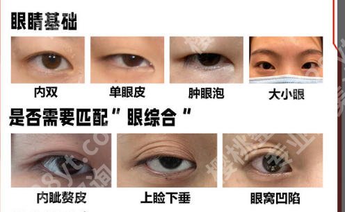 朝阳医院做双眼皮怎么样？适合不同眼部基础的医生推荐