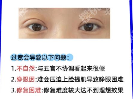 成都市第二人民医院双眼皮怎么样？真实体验分享、避坑不踩雷