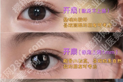 汕头附一双眼皮纪医生怎么样？附技术分析与医生信息一览