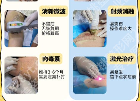 上海华山医院整形科做狐臭多少钱？患者亲测体验大公开