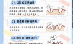 台州医院种植牙多少钱？2026牙科种植牙收费价目表来袭！