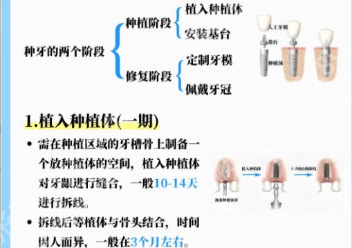台州医院种植牙多少钱？2026牙科种植牙收费价目表来袭！