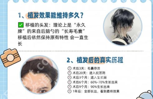上海第九医院植发价格揭晓！手术方案费用详解！