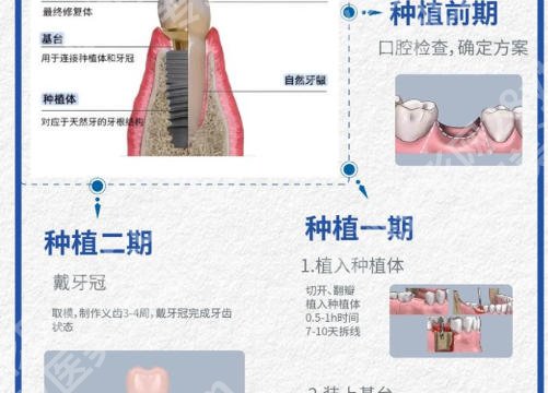 广州华侨医院口腔科看病贵吗?项目明细与性价比全面解析