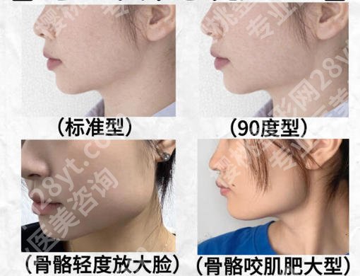 上海第六人民医院做下角手术好吗？实力揭秘、价格表参考！