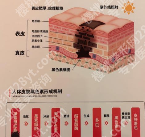 安医大一附属医院激光祛斑怎么样？汇集技术介绍与医生信息来了