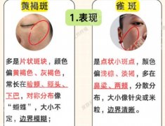 中山大学附属第一医院美容科价格表曝光！价格表更新、附真实案例