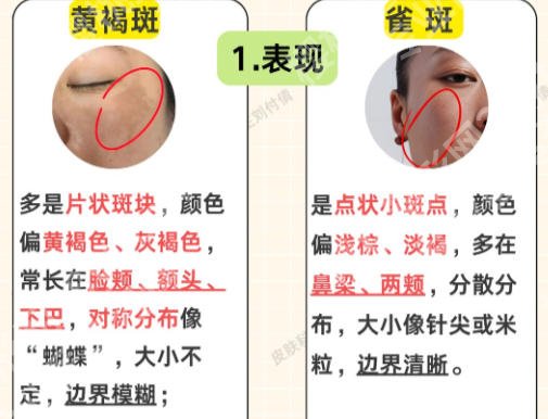 中山大学附属第一医院美容科价格表曝光！价格表更新、附真实案例