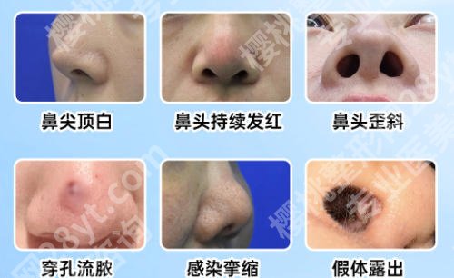 中山大学附属第一医院美容科价格表曝光！价格表更新、附真实案例