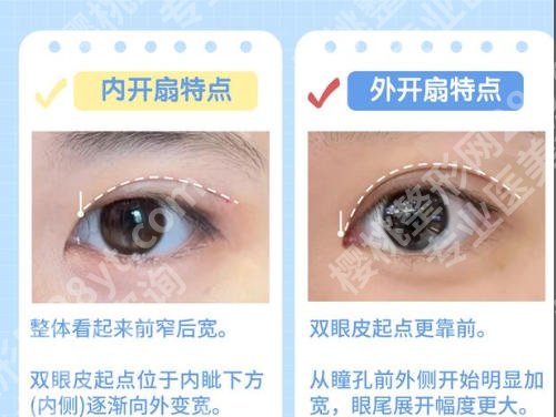 重庆新桥医院做双眼皮多少钱?价格及避坑指南严选