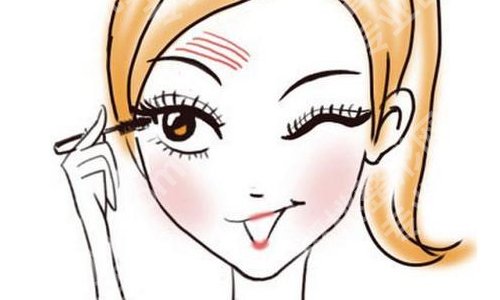 合肥双眼皮修复周瑜做的好吗？案例反馈、术前、术后小贴士等更新！