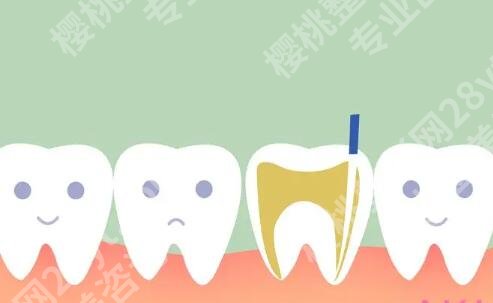上海九院牙齿根管治疗多少钱一颗?费用表+科室情况这里扒透