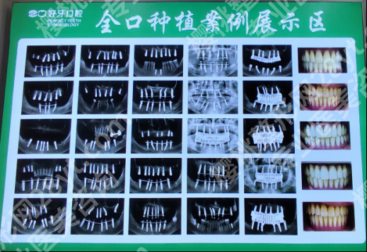 2026种植牙品牌怎么选?北京好牙口腔用三个硬核指标帮你把关,种植不踩坑