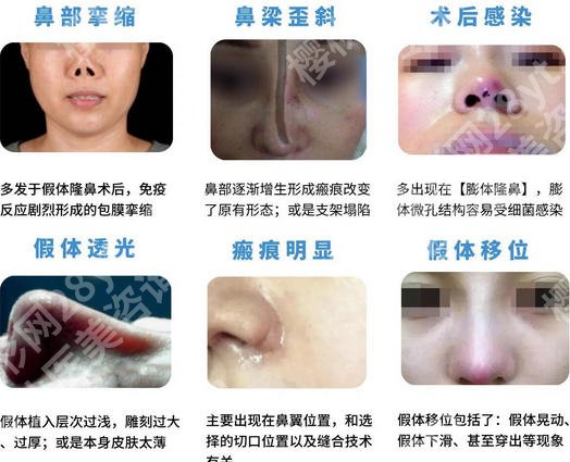 上海九院谁做鼻修复好?top榜前五名单揭晓!钱云良|王琛排名靠前!