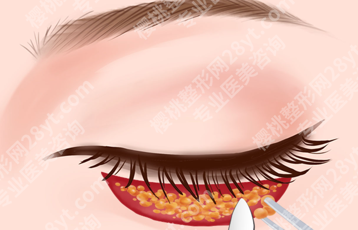 云南去眼袋哪家医院好?医美资源盘点,这几家医院关注度不低