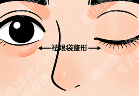 兰州去眼袋正规的医院有哪些?2026年本地机构盘点,资质、技术和特色一次看明白