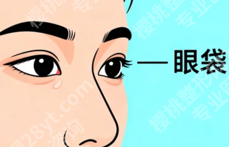 济南去眼袋哪个医生做得好?热门医生资料汇总,技术路线各有讲究