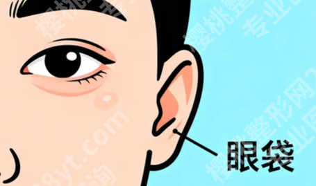 贵阳去眼袋哪家医院好?2026年10月关注名单,这些医疗机构值得了解