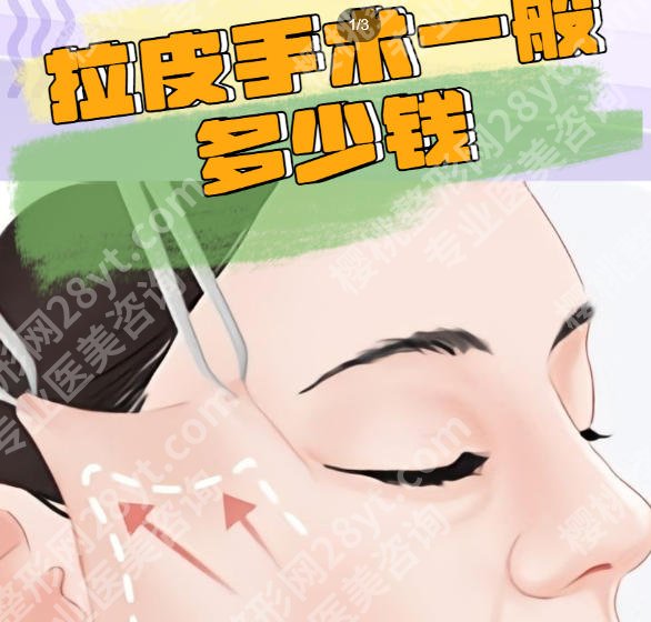 上海九院美容整形大拉皮一般多少钱？2026价目表更新！点击一览