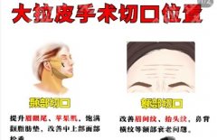 上海九院的拉皮技术好吗？医院排行榜公布！审美干货分享！