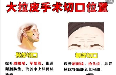 上海九院的拉皮技术好吗？医院排行榜公布！审美干货分享！