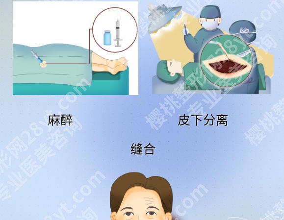 上海九院的拉皮技术好吗？医院排行榜公布！审美干货分享！