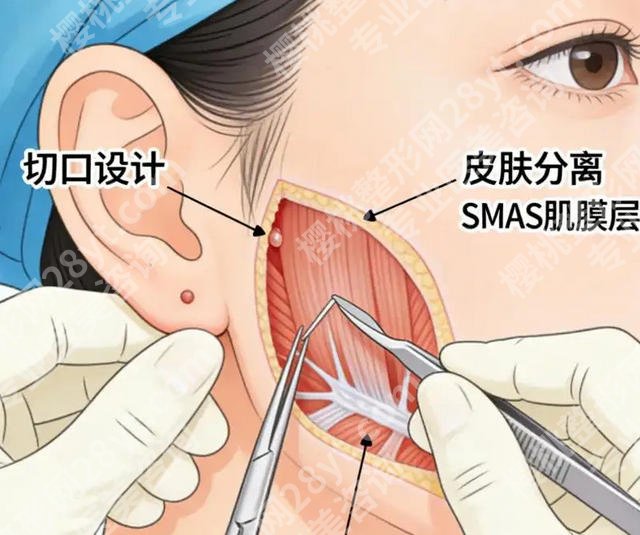 上海九院做拉皮谁做的最好？张余光、李青峰口碑好！戳进来看